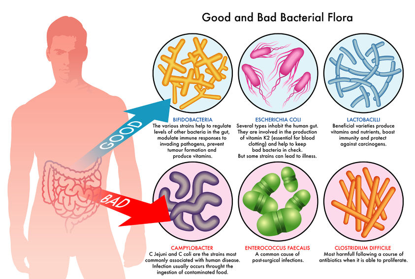 probiotics good vs bad